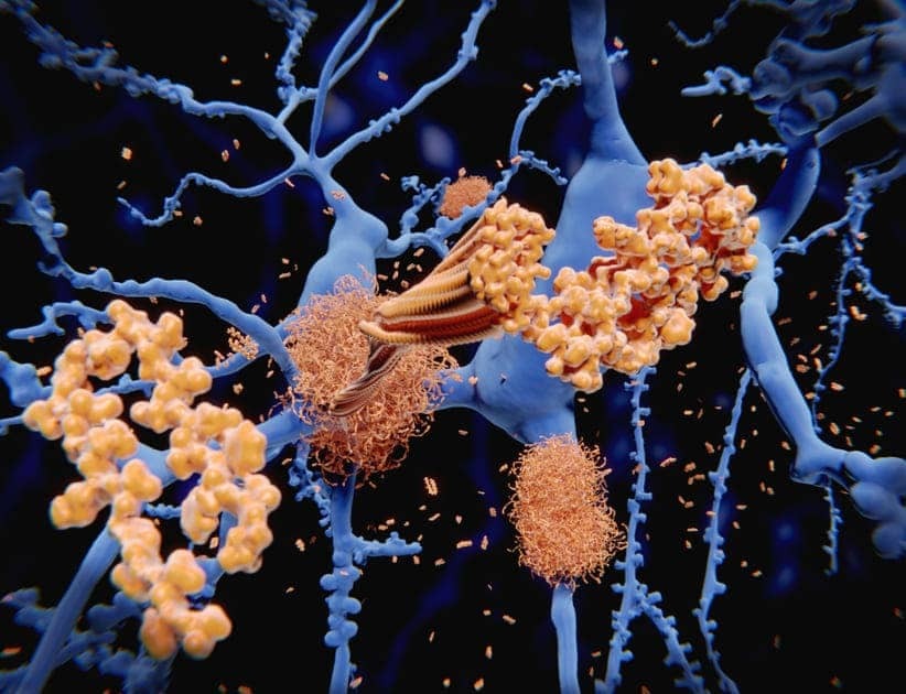 Alzheimer's Proteins: Understanding the Cause - News Directory 3